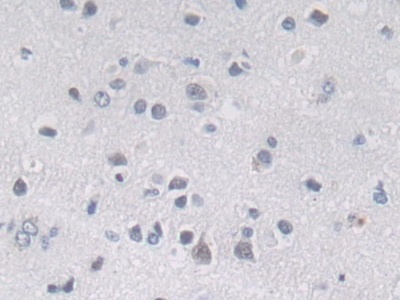 Polyclonal Antibody to Mindbomb Homolog 2 (MIB2)