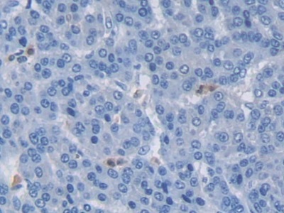 Polyclonal Antibody to Mindbomb Homolog 2 (MIB2)