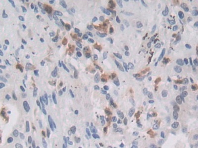 Polyclonal Antibody to Mindbomb Homolog 2 (MIB2)