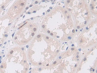 Polyclonal Antibody to Mindbomb Homolog 2 (MIB2)