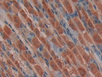 Polyclonal Antibody to Mindbomb Homolog 2 (MIB2)