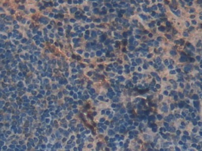 Polyclonal Antibody to Mindbomb Homolog 2 (MIB2)