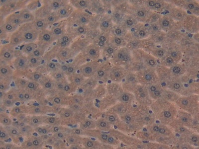 Polyclonal Antibody to Mindbomb Homolog 2 (MIB2)