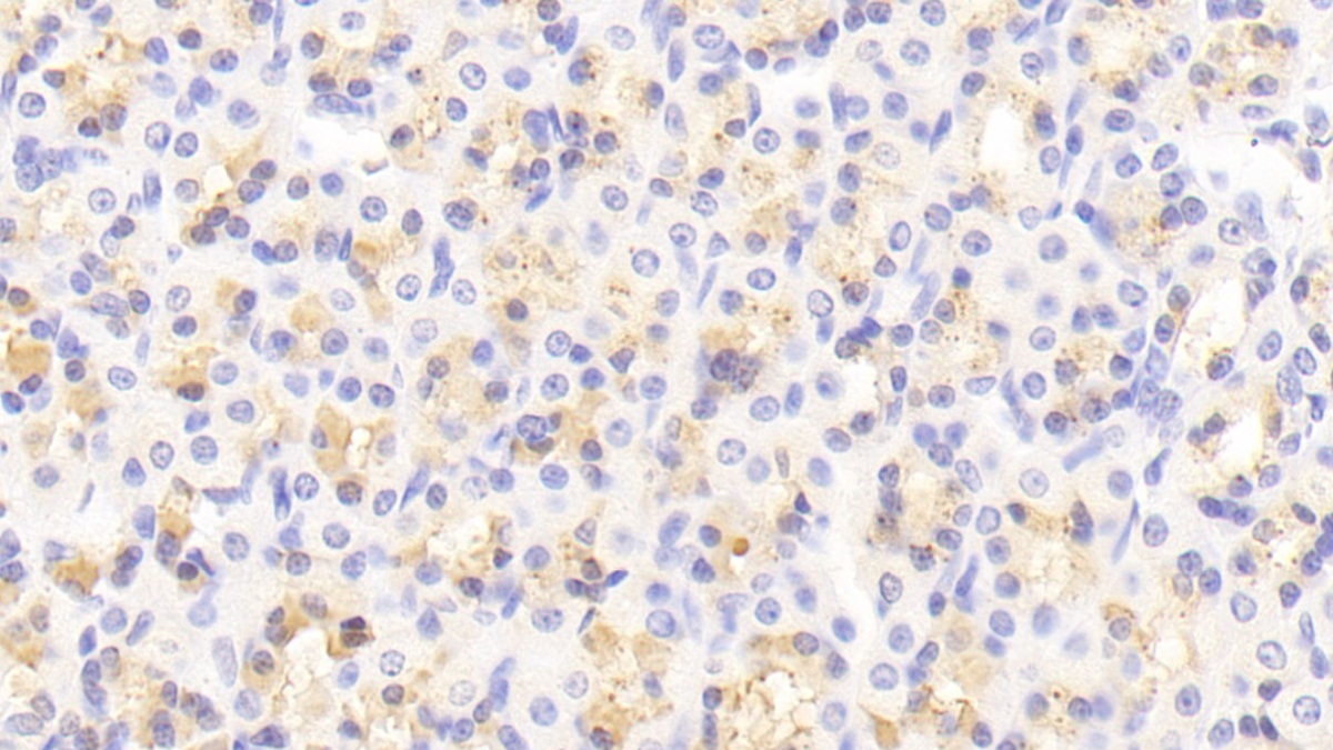 Polyclonal Antibody to Mindbomb Homolog 2 (MIB2)