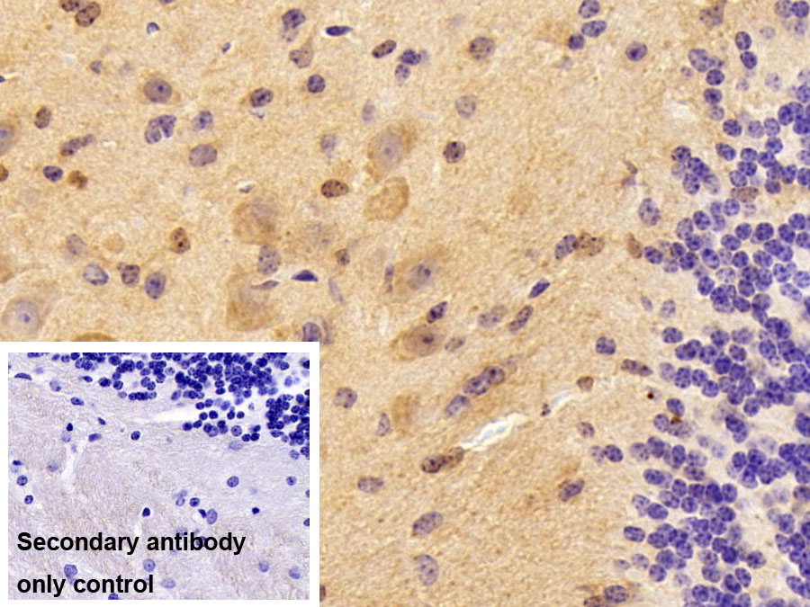 Polyclonal Antibody to Microtubule Associated Monoxygenase, Calponin And LIM Domain Containing Protein 2 (MICAL2)