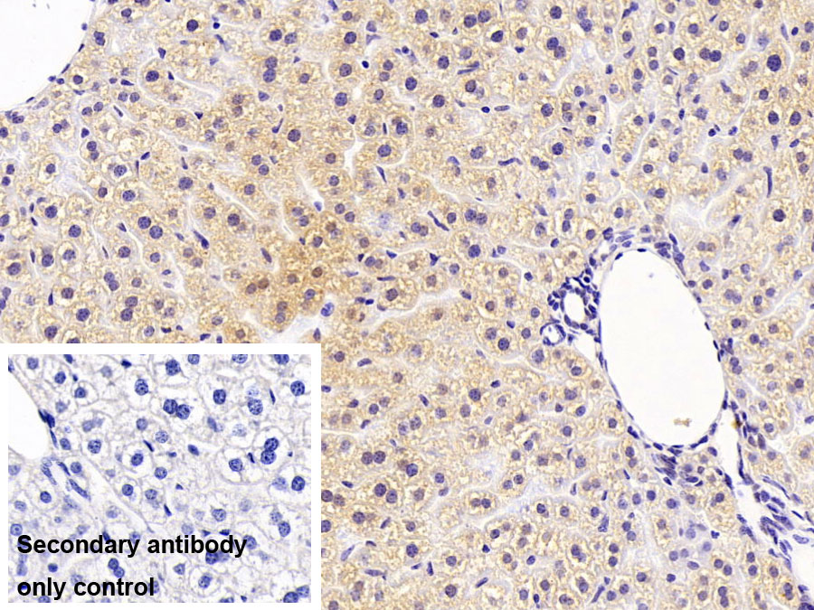 Polyclonal Antibody to Microtubule Associated Monoxygenase, Calponin And LIM Domain Containing Protein 2 (MICAL2)