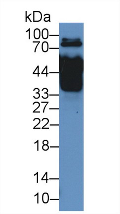 Polyclonal Antibody to Myxovirus Resistance 1 (MX1)