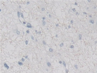 Polyclonal Antibody to Myxovirus Resistance 2 (MX2)