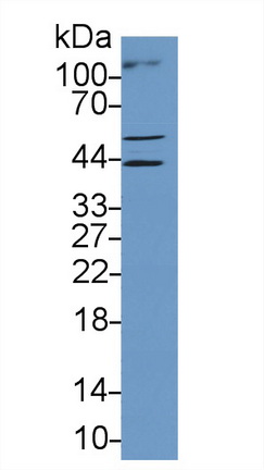 Polyclonal Antibody to V-Myc Myelocytomatosis Viral Oncogene Homolog 1, Lung Carcinoma Derived (MYCL1)