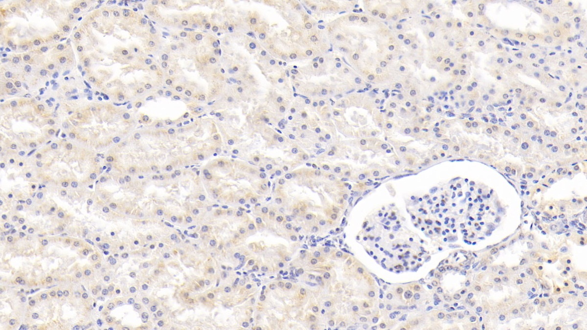 Polyclonal Antibody to Wingless Type MMTV Integration Site Family, Member 1 (WNT1)