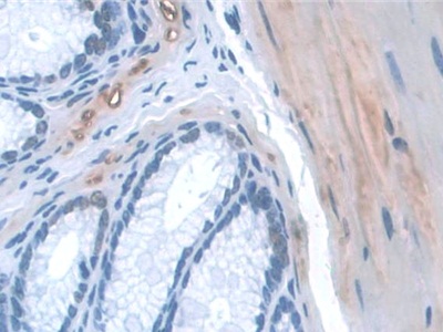 Polyclonal Antibody to Kidney And Brain Protein (KIBRA)