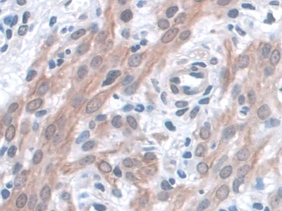 Polyclonal Antibody to Kidney And Brain Protein (KIBRA)