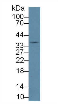 Polyclonal Antibody to Otubain 1 (OTUB1)