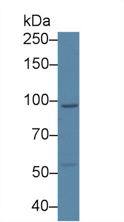 Polyclonal Antibody to USP6 N-Terminal Like Protein (USP6NL)