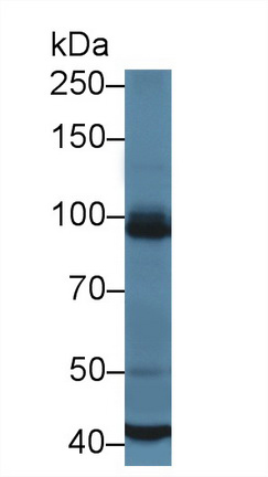 Polyclonal Antibody to USP6 N-Terminal Like Protein (USP6NL)