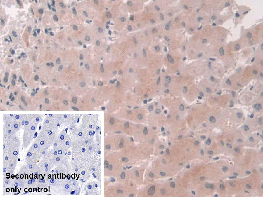 Polyclonal Antibody to USP6 N-Terminal Like Protein (USP6NL)