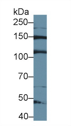 Polyclonal Antibody to Uveal Autoantigen With Coiled Coil Domains And Ankyrin Repeats (UACA)