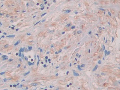 Polyclonal Antibody to Semaphorin 3A (SEMA3A)