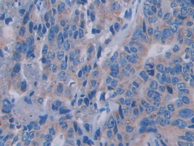 Polyclonal Antibody to Semaphorin 3A (SEMA3A)