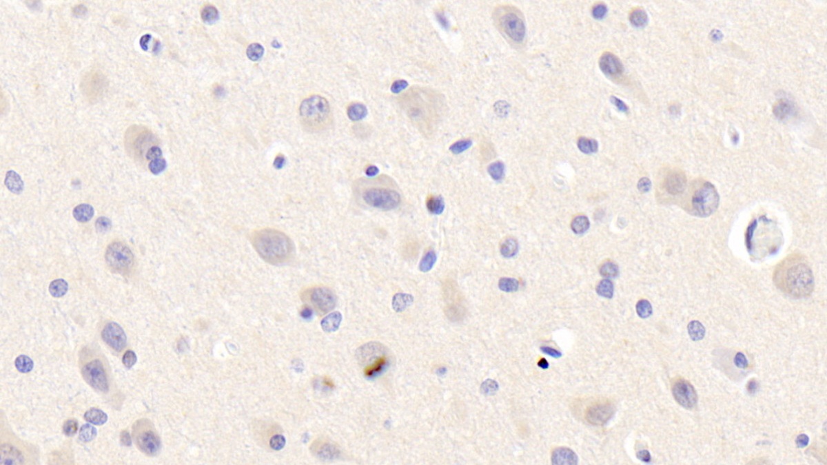 Polyclonal Antibody to Semaphorin 3A (SEMA3A)