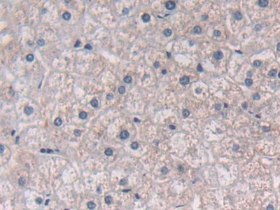 Polyclonal Antibody to Semaphorin 3E (SEMA3E)