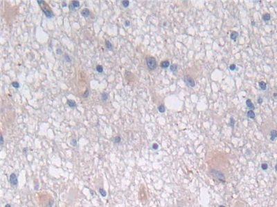 Polyclonal Antibody to Semaphorin 3E (SEMA3E)