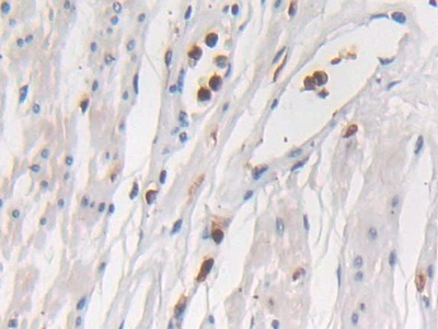 Polyclonal Antibody to Semaphorin 3E (SEMA3E)