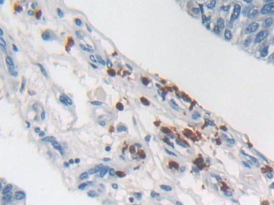 Polyclonal Antibody to Semaphorin 3E (SEMA3E)