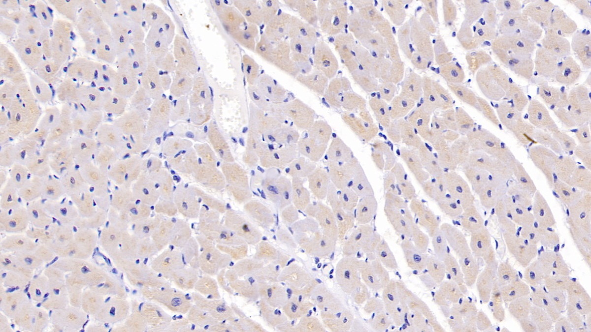 Polyclonal Antibody to Semaphorin 5B (SEMA5B)