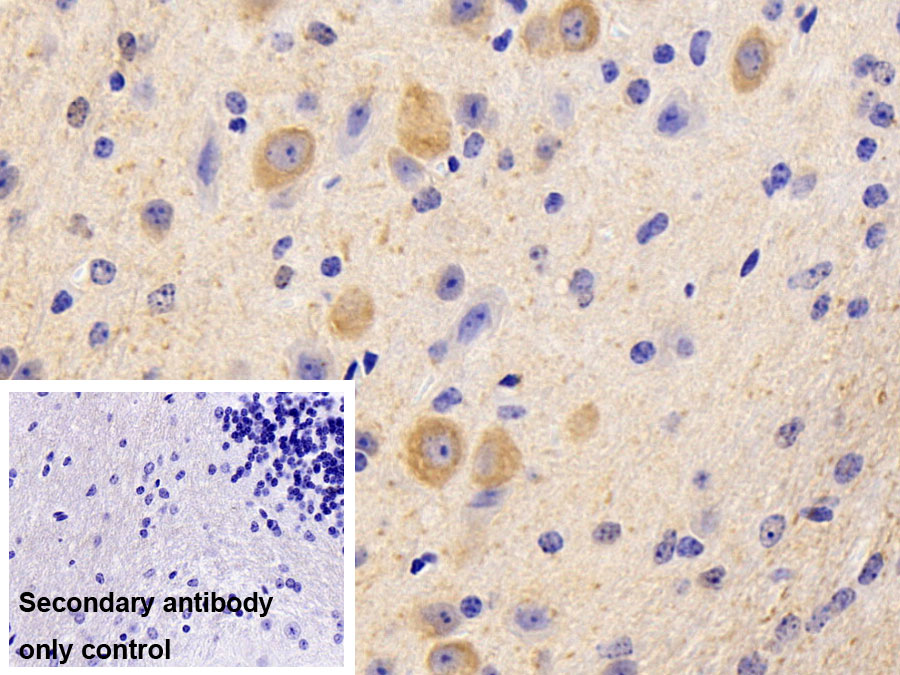 Polyclonal Antibody to Semaphorin 5B (SEMA5B)