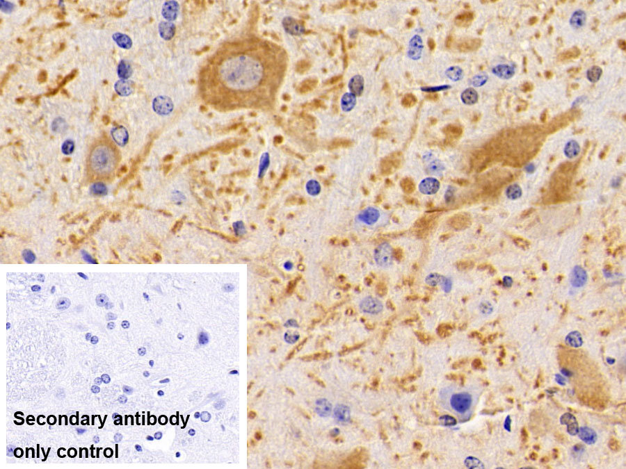 Polyclonal Antibody to Semaphorin 5B (SEMA5B)