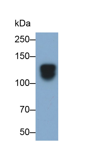 Polyclonal Antibody to Semaphorin 5B (SEMA5B)