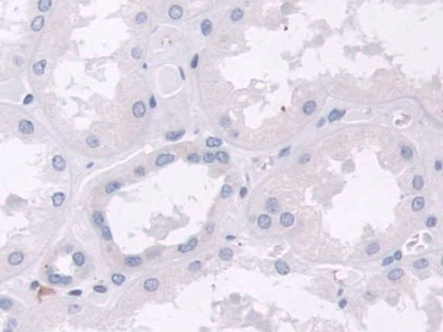 Polyclonal Antibody to NEL Like Protein 2 (NELL2)