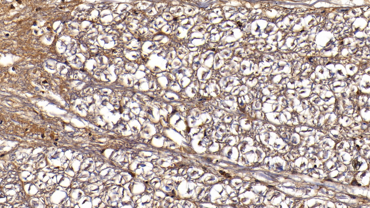 Polyclonal Antibody to Neogenin 1 (NEO1)