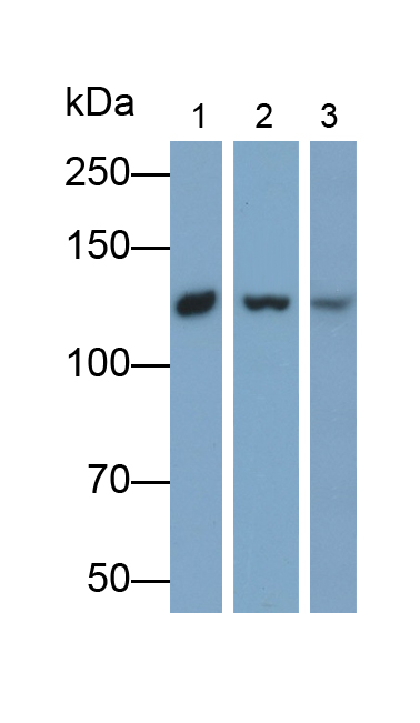 Polyclonal Antibody to Neurofascin (NFASC)