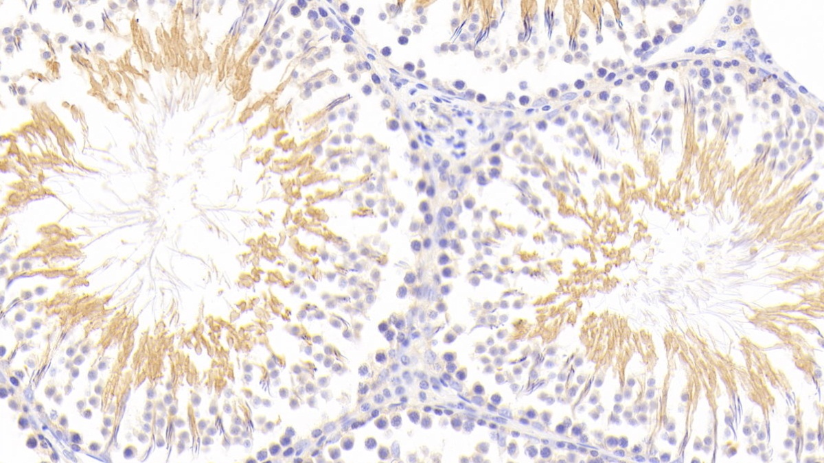 Polyclonal Antibody to Nuclear Factor, Erythroid Derived 2 Like Protein 2 (NFE2L2)