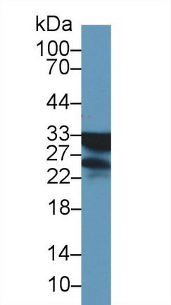 Polyclonal Antibody to NADH Dehydrogenase, Quinone 1 (NQO1)