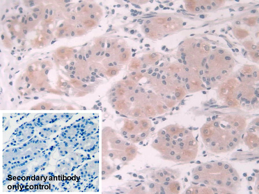 Polyclonal Antibody to NADH Dehydrogenase, Quinone 1 (NQO1)