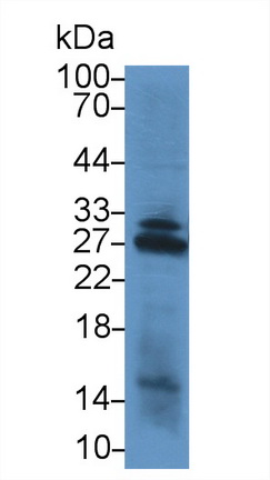 Polyclonal Antibody to NADH Dehydrogenase, Quinone 1 (NQO1)