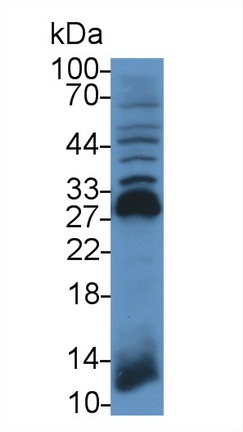 Polyclonal Antibody to NADH Dehydrogenase, Quinone 1 (NQO1)