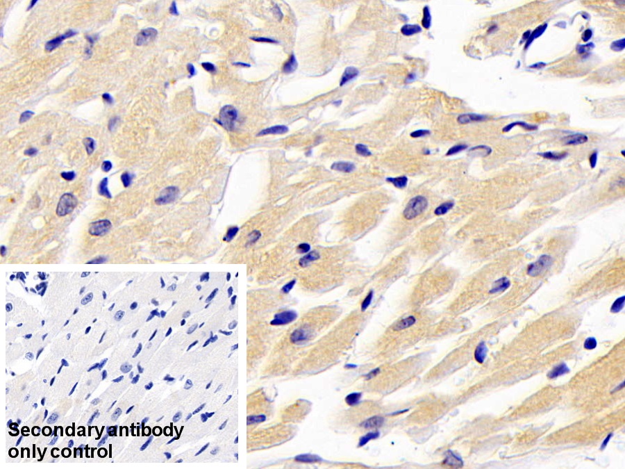 Polyclonal Antibody to NUAK Family SNF1 Like Kinase 1 (NUAK1)