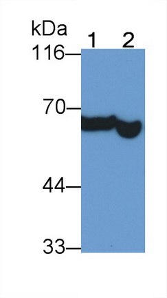 Polyclonal Antibody to Ribosomal Protein S6 Kinase Beta 1 (RPS6Kb1)