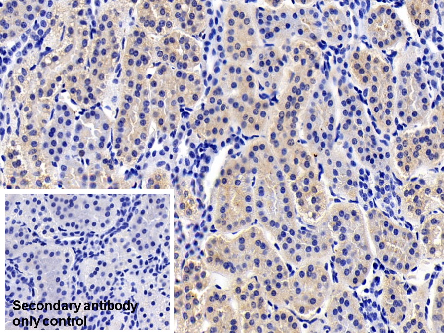 Polyclonal Antibody to Ribosomal Protein S6 Kinase Beta 1 (RPS6Kb1)