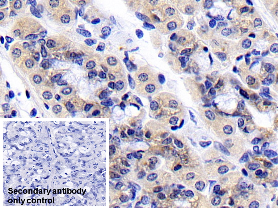 Polyclonal Antibody to Ribosomal Protein S6 Kinase Beta 1 (RPS6Kb1)