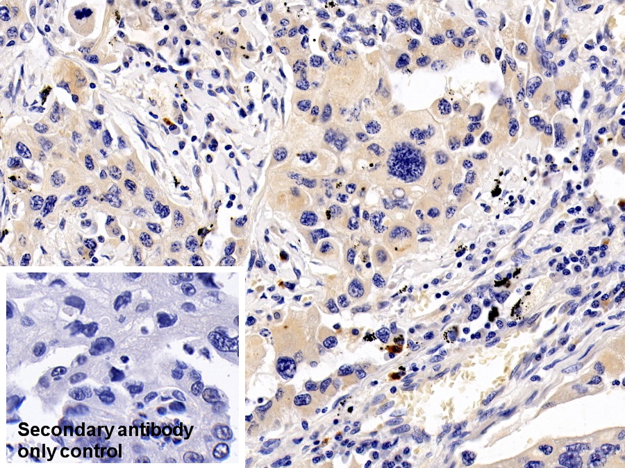 Polyclonal Antibody to Ribosomal Protein S6 Kinase Beta 1 (RPS6Kb1)