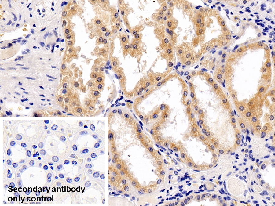 Polyclonal Antibody to Ribosomal Protein S6 Kinase Beta 1 (RPS6Kb1)