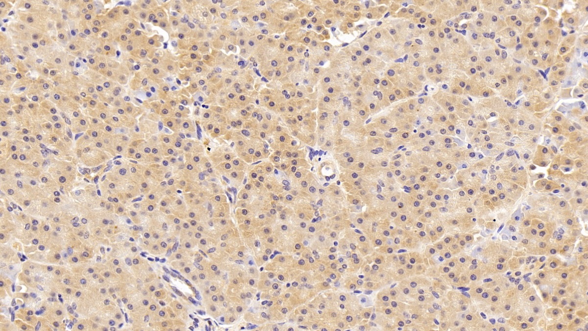 Polyclonal Antibody to Protein L-Isoaspartate-O-Methyltransferase (PCMT1)