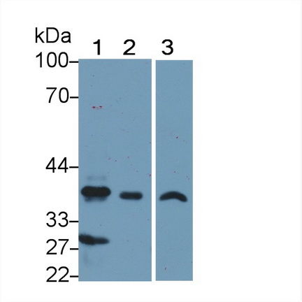 Polyclonal Antibody to PDZ And LIM Domain Protein 1 (PDLIM1)