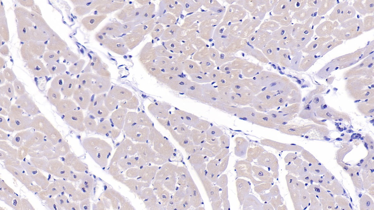 Polyclonal Antibody to PDZ And LIM Domain Protein 1 (PDLIM1)