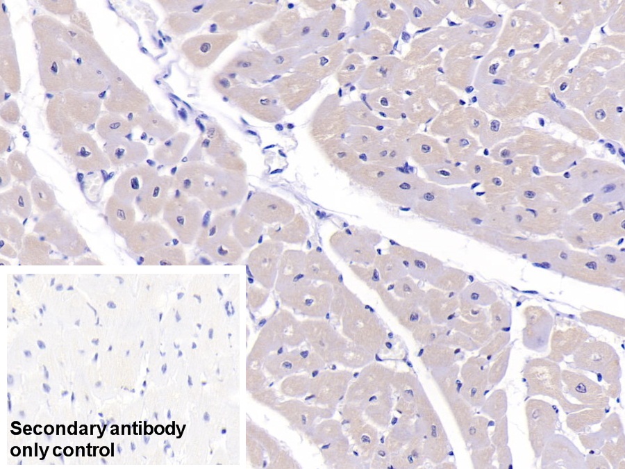 Polyclonal Antibody to PDZ And LIM Domain Protein 1 (PDLIM1)